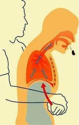 重点知识：学会海姆立克急救法