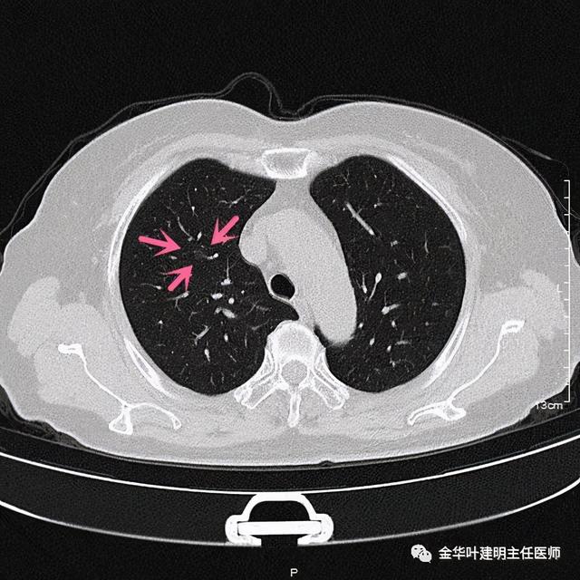 如此违反原则的手术方案设计，你支持吗？