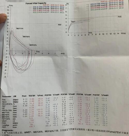 咳嗽|31岁男子咳嗽久治不愈？拖了6年，竟是这种“变异病”