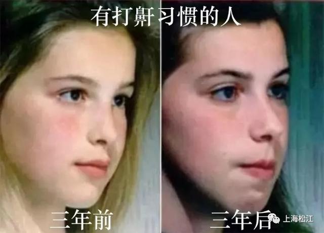 打鼾|你睡觉打呼噜吗？这种情况很危险