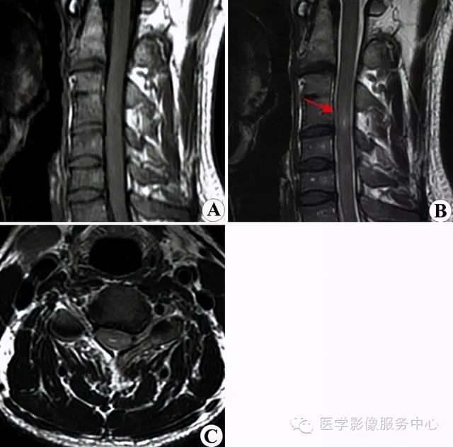 77种骨肌影像病例，助你诊断无忧