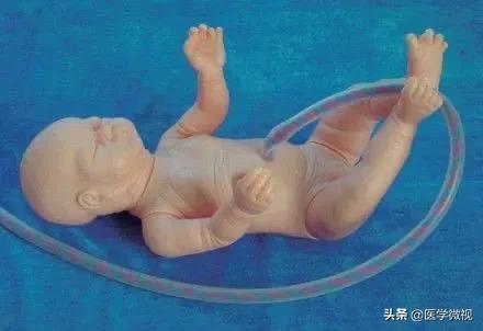 「你的育儿经」肚脐修炼史：拥有一个好看的肚脐眼儿竟然这么难？
