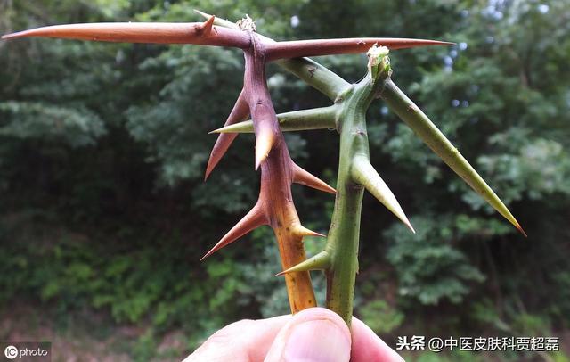 消肿排脓、祛风止痒、治疗痤疮和皮肤瘙痒，还能止痛的皂角刺