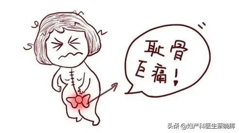 #超级宝妈#孕期肚子下面骨头疼痛难忍，你有过这种感受吗？