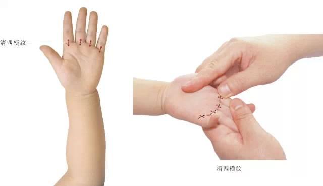 『你的育儿经』【每日一穴】小儿推拿手臂部常用穴位四横纹(南派又称小横纹)—13