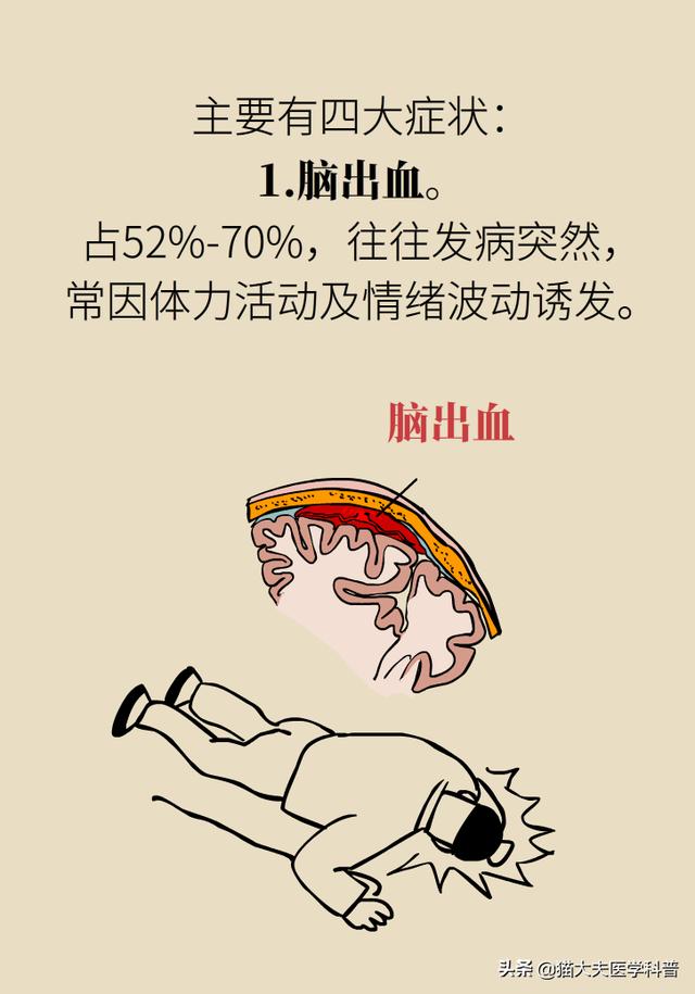 脑血管畸形是什么鬼？是天生的吗？