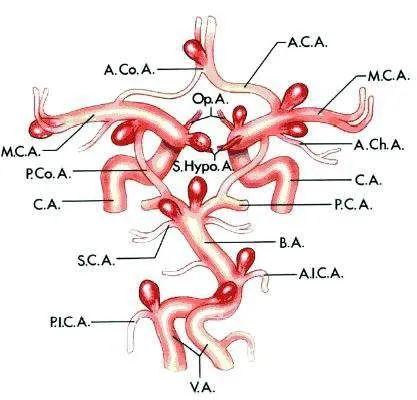 脑内的Willis环，你知道吗？