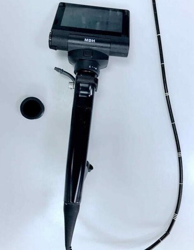 真·如鲠在喉！济一2个月小孩嗓子里长了巨大肿瘤