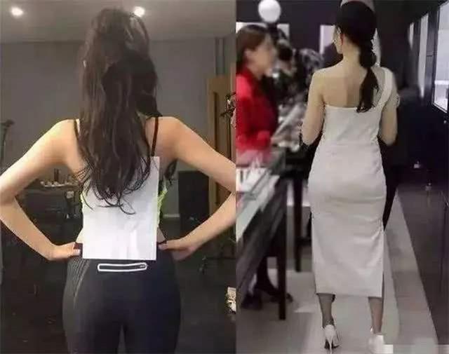 「你的育儿经」“少女胯”和“妈妈胯”有何区别?医生直言:生没生过娃一眼便知