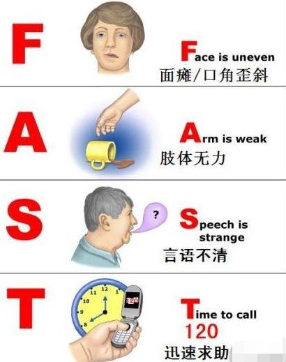 早期脑梗有哪些信号？为什么医生一再强调「FAST」