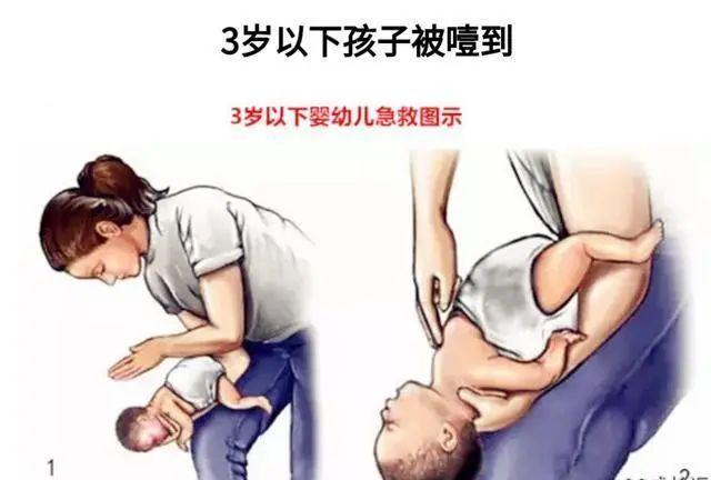 小莉|因为半颗花生米，丽水一个16个月的宝宝险丧命