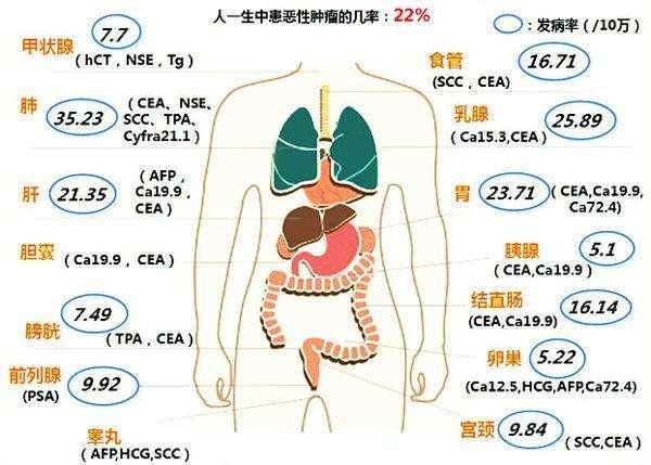 恶性肿瘤|辟谣：肿瘤标志物升高就是得癌症了吗？常见肿瘤标志物解读！