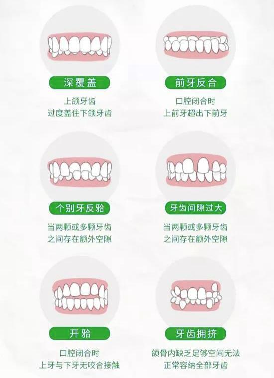 牙齿|隐形矫治器3990元补贴计划 在第三届正畸学高峰论“正”会上启动