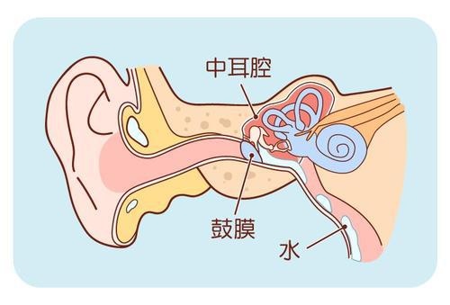 幼童中耳炎致鼓膜穿孔，儿童反复感冒发烧要当心