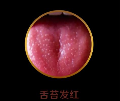 你的育儿经|看舌头，看健康！宝宝这4种常见舌象，都反映什么问题？
