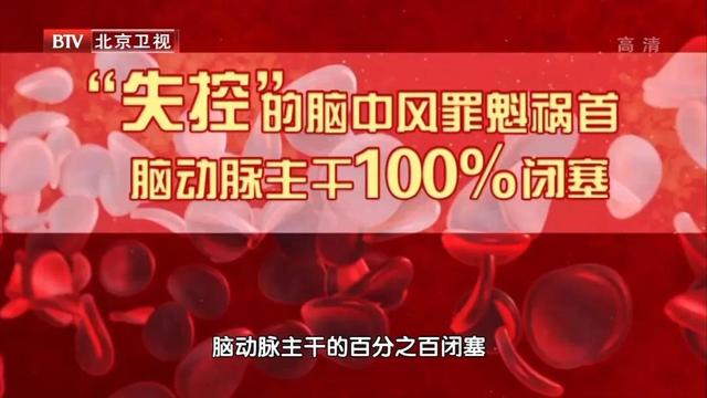 一咳嗽就眩晕呕吐，可能是大脑主动脉全堵了！警惕失控的脑中风