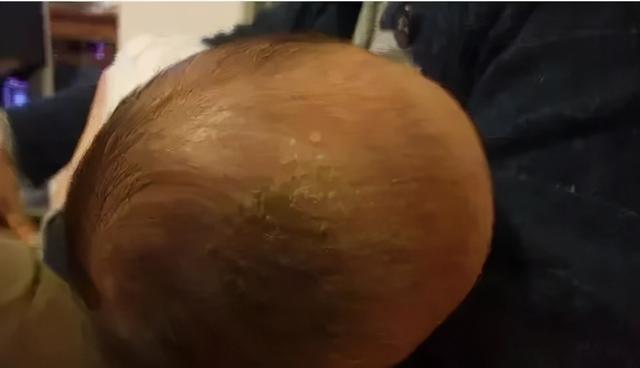 宝宝身上有4个“耐脏”部位，家长平时别勤洗，小心好心办坏事