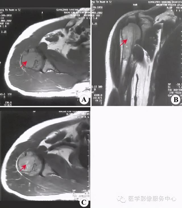 收藏 |：79种典型骨肌影像病例，助你诊断无忧