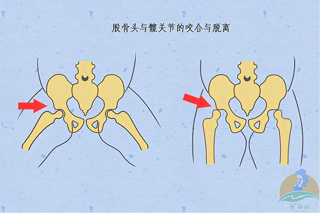 宝宝腿型不直、O型腿？别光顾着补钙，做好三个细节事半功倍