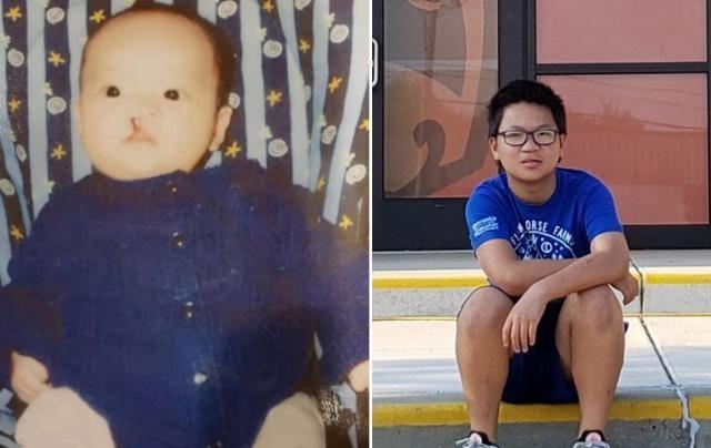 「超级宝妈」如何帮助腭裂宝宝进行语言训练，我们是这样的做的