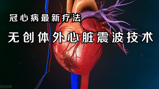 无创体外心脏震波疗法对于冠心病，是一种什么治疗？医生详细介绍