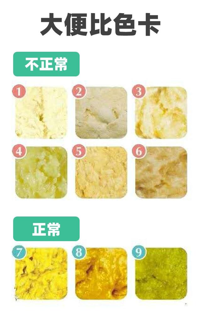 [你的育儿经]孩子身上出现这些颜色，是健康警报，却总被忽视