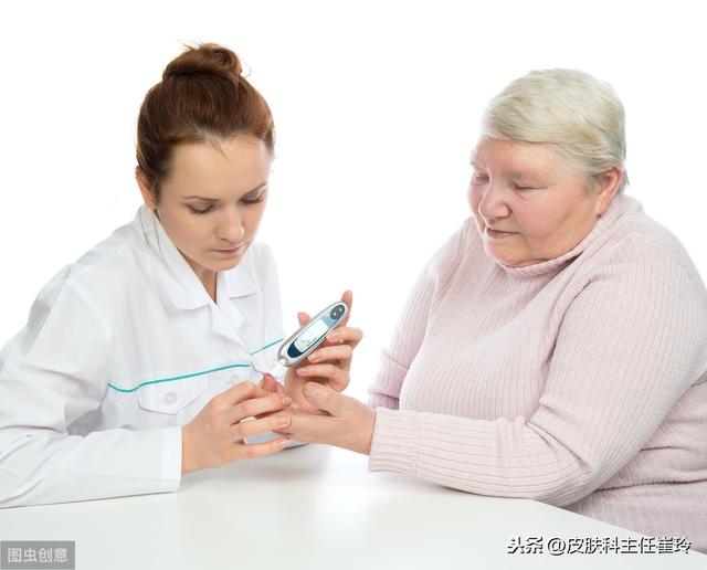 【超级宝妈】详解儿童白癜风的分类是哪些