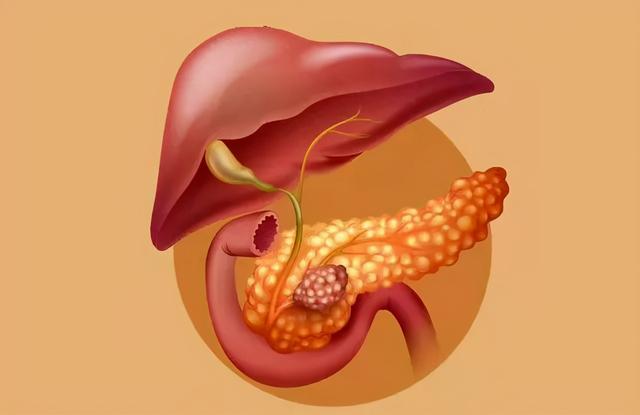 怀孕5个月，恶性肿瘤：这种癌生存率不足5%，极易被误诊为胃病