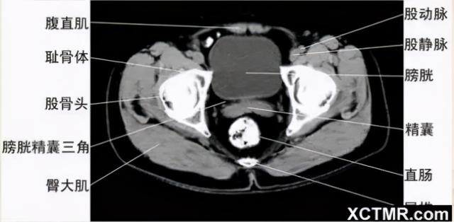 影像解剖：胸、腹部、盆腔CT解剖