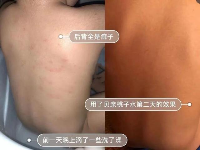 超级宝妈|日本贝亲桃子水，真的这么好用吗