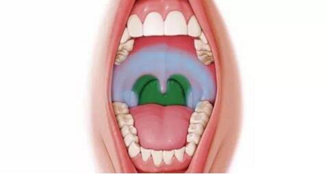 逗比大家庭|疱疹性咽峡炎又到高发期！别与手足口病、口腔溃疡搞混了