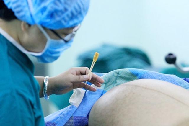 超级宝妈|剖腹产原来有那么多的隐患，孕妈要早知道，能顺产就别剖