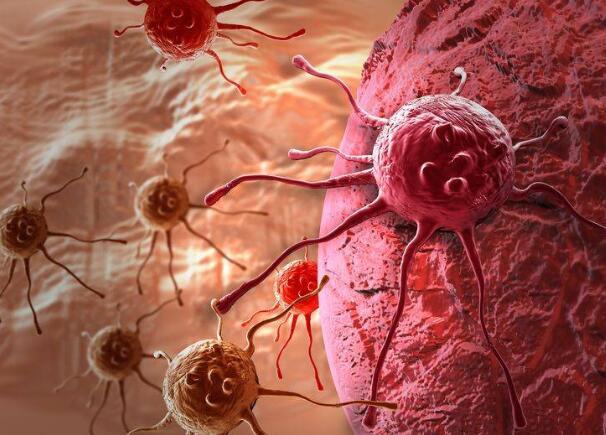 病从口入！医生告诫：4个饮食习惯让你“吃”出癌症，趁早改正