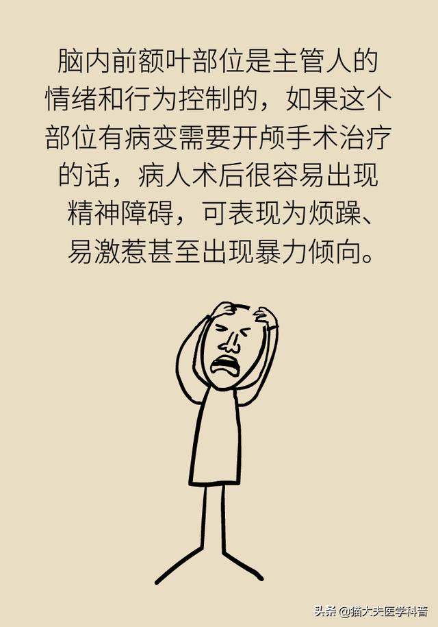 开颅手术就是“打开人的天灵盖”？我怀疑你是个古代人