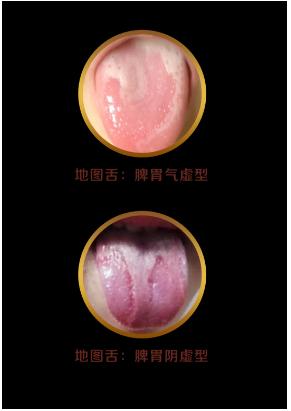 你的育儿经|看舌头，看健康！宝宝这4种常见舌象，都反映什么问题？