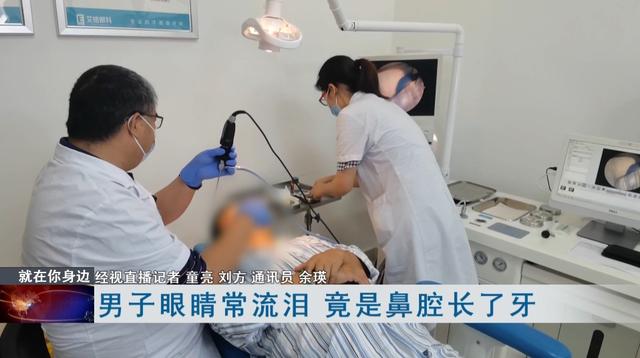 囊肿|惊呆！武汉一男子鼻腔长了牙，医生：从医40年没见过这种情况