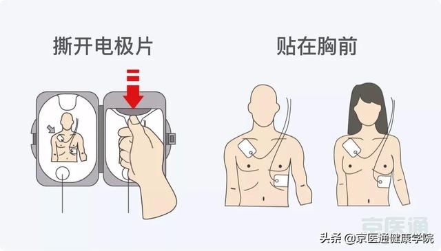 突发意外&quot;救命神器AED&quot;怎么用？每个人都要学会