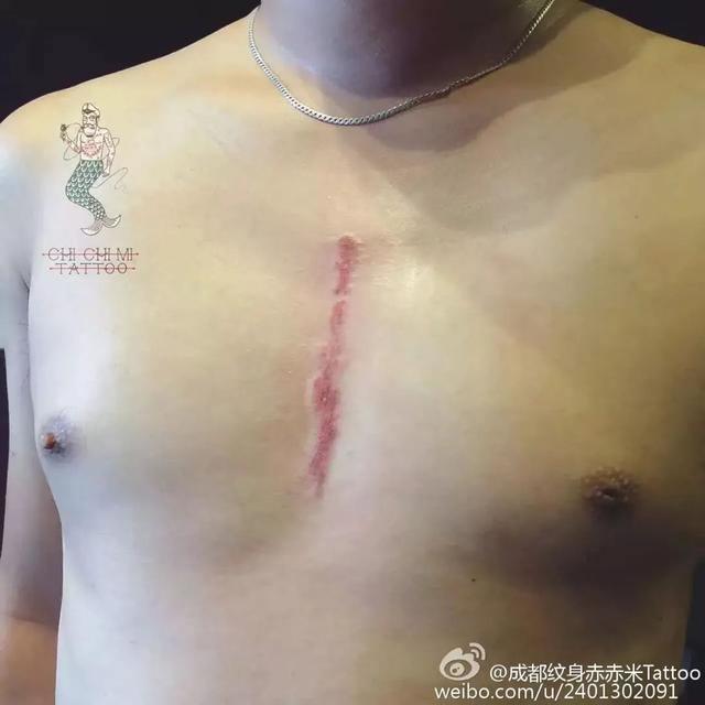 老鹰捉小鸡|满月宝宝患重症，亲友劝放弃，爸爸：“再生一个就不是他了”