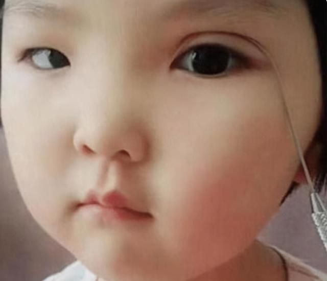 嫌弃女儿单眼皮拉低颜值，妈妈使出这一招，网友：前后反差有点大