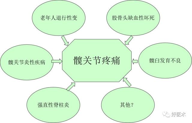 一文读懂髋关节撞击综合征