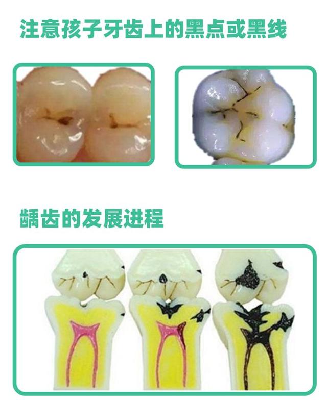 [你的育儿经]孩子身上出现这些颜色，是健康警报，却总被忽视