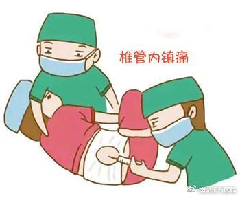 你的育儿经|无痛分娩前后的那些“坎”？宝妈赶紧来围观，满满的干货