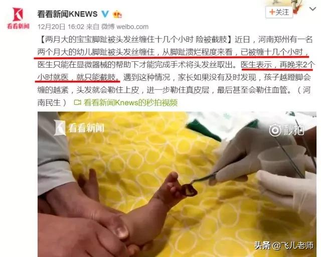 超级宝妈@2月龄宝宝差点被截肢，原因竟然是我们意想不到的东西