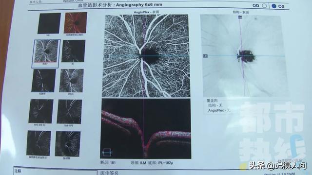 西安程序员一周熬夜5天竟患上......医生：发病率为十万分之二