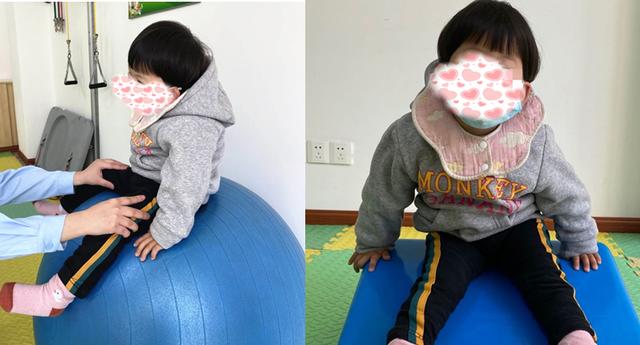 笑看人生|【科普工作委员会】 脑瘫宝宝W型坐姿千万要不得