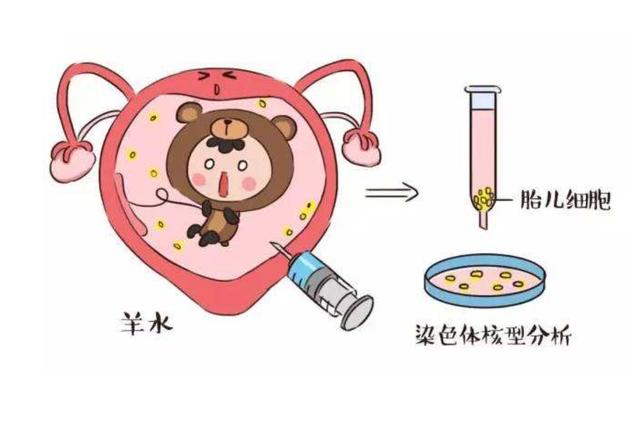 你的育儿经@孕妈请了解！怀孕后，这3个坏习惯孕妈不能有，羊水质量变差