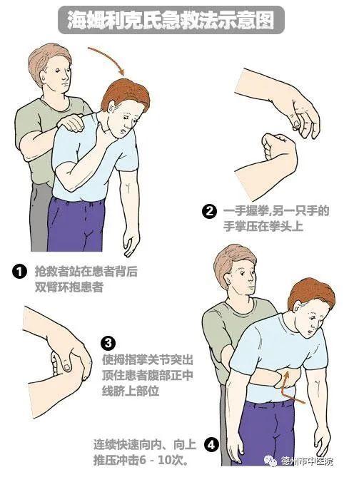 超级宝妈：小儿窒息家长别急，德州市中医院急救专家教您这样做！