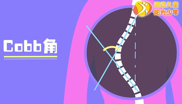 健康学堂|孩子高低肩，可能是病，这些脊柱侧凸自查方法，家长们一定要收藏