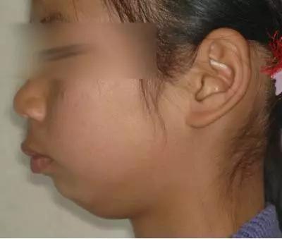 「你的育儿经」你以为的换牙期小问题，可别影响了孩子的一生！