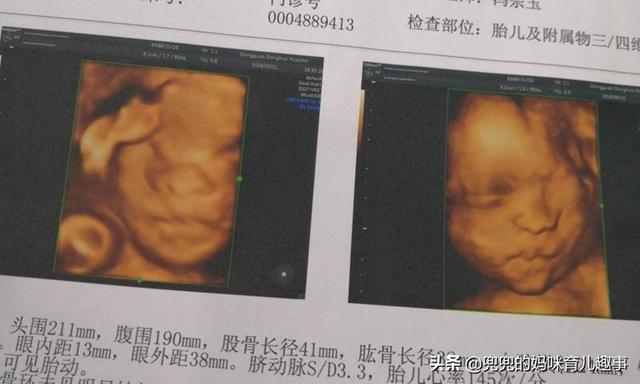 「超级宝妈」孕期准妈妈如果遇到这些情况，就自己拿主意吧，医生也帮不了你！